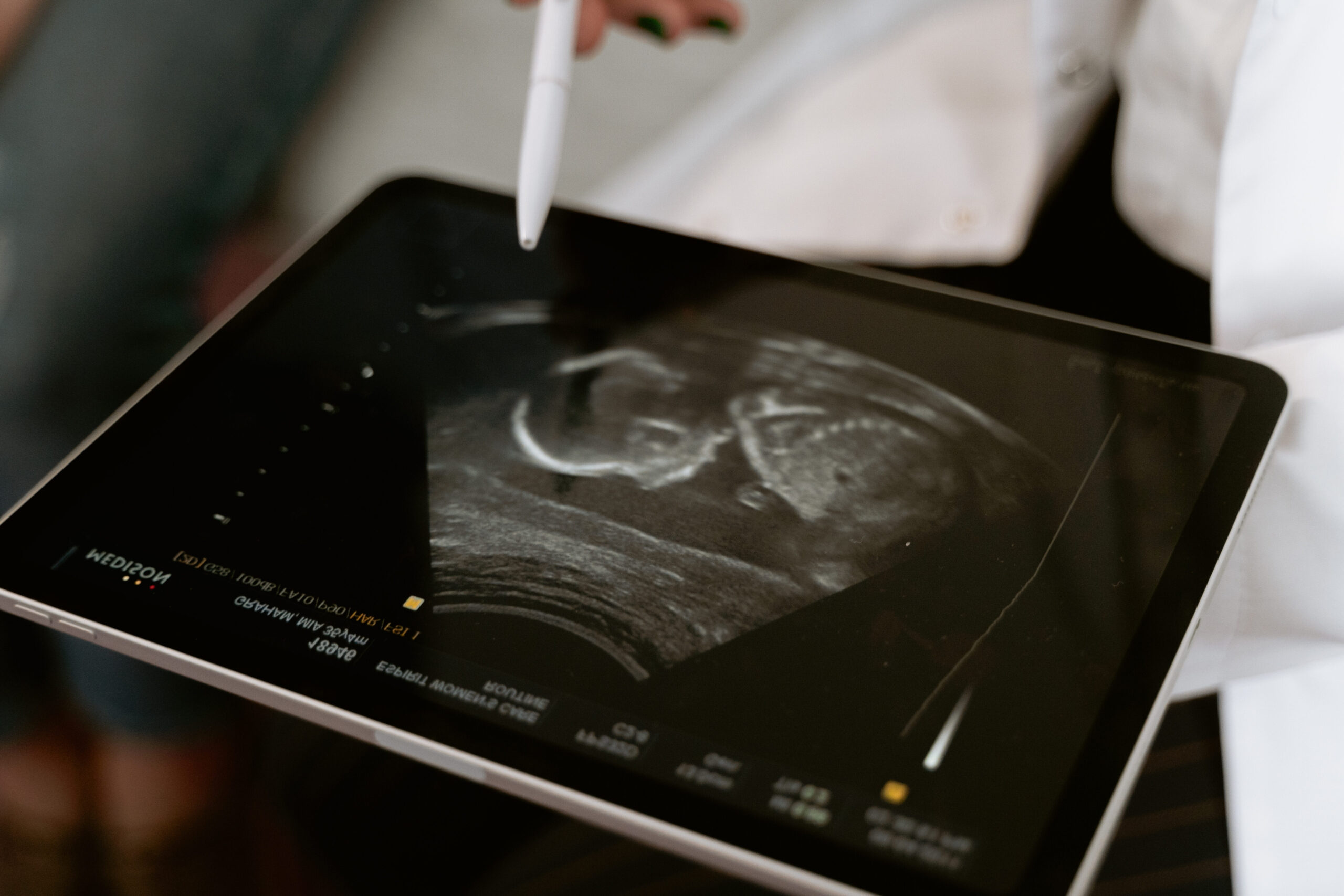 Ampliador de Pantalla para Tablet: Mejora tu Experiencia Visual ¡Sin esfuerzo!